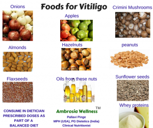 Vitiligo foods, diet, nutrition