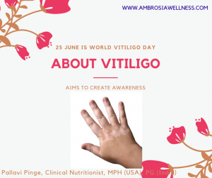 Vitiligo meaning, causes, symptoms, awareness